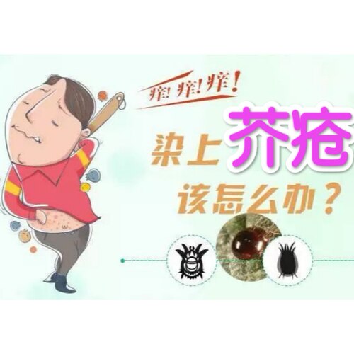 疥螨一喷净虱子百部酊