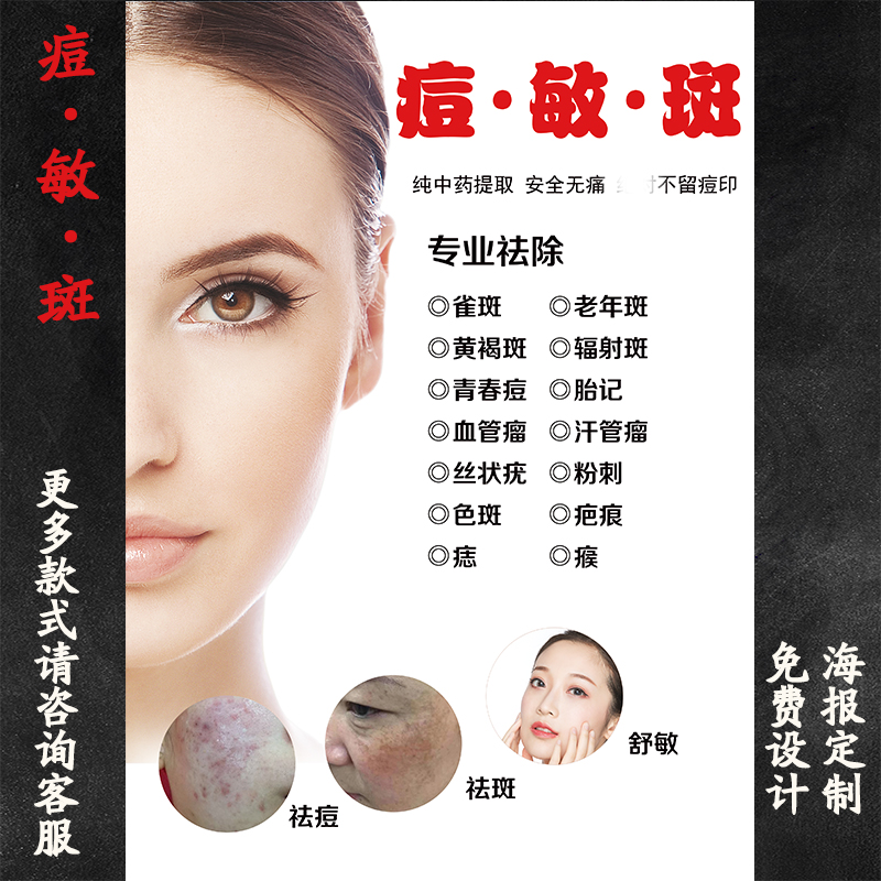 痘敏斑海报宣传画专业祛斑祛痘海报广告画痤疮过敏激素脸图片墙贴