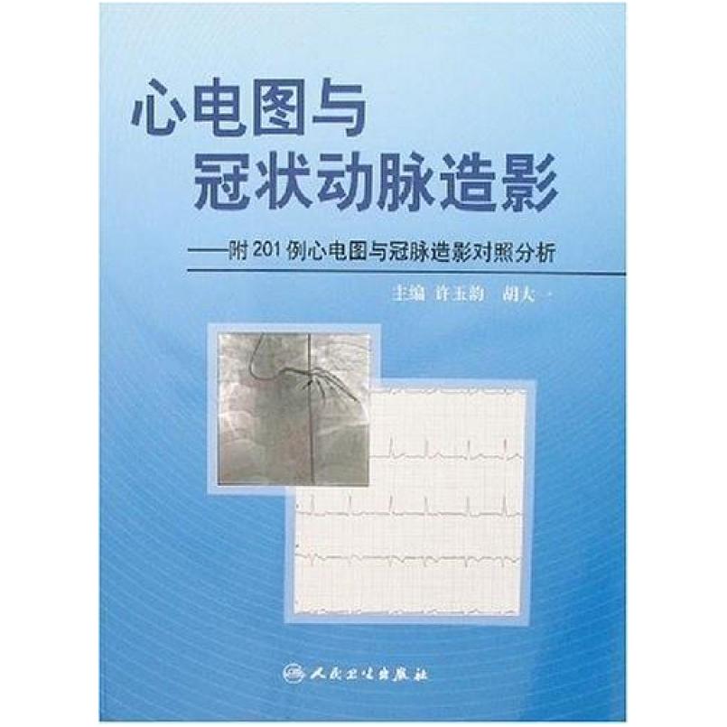二手心电图与冠状动脉造影 许玉韵 人民卫生出版社