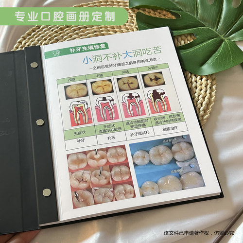 口腔咨询师专用沟通讲解图册