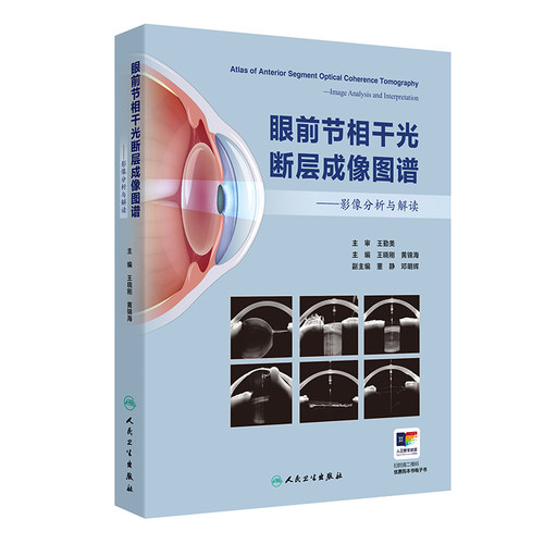 正版图书眼前节相干光断层成像图谱——影像分析与解读王晓刚，黄锦海人民卫生出版社书籍\/杂志\/报纸/医学卫生/医学纸质书籍