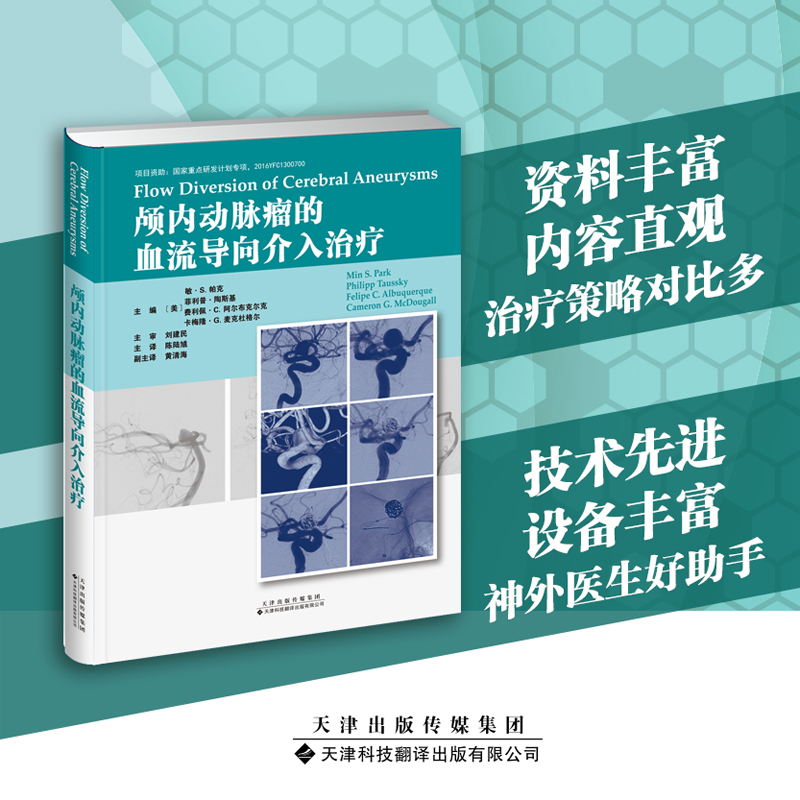 临床颅内动脉瘤的血流导向介入治血液分流的起源血液分流理论基础展开血流装置的操作方法治疗决策管理技术选择手术康复书籍