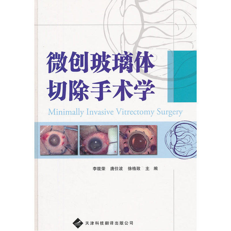 微创玻璃体切除手术学 精 可作为微创玻璃体切除术初学者的教材 李筱荣 唐仕波 徐格致 主编