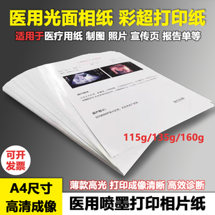 b超打印纸A4相纸医用照片打印纸 胃镜彩超报告纸薄款医院宣传海报