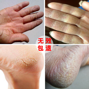 凝胶手套袜套防裂嫩白手脚足开裂干裂保湿脚后跟保护套防裂套男女