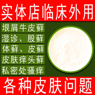 皮肤疹湿痒膏外用皮炎体股头藓 大腿私处皮肤瘙痒 身体过敏止痒药