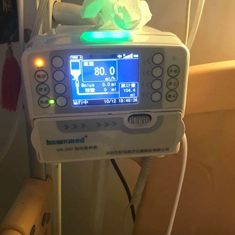 医用肠内营养泵带加热可调速喂养泵鼻饲泵营养输液泵流食泵奶泵kx
