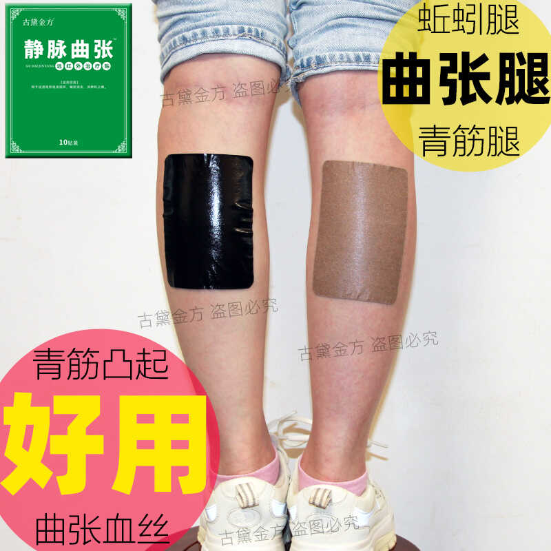 古黛金方曲张贴小腿青筋红血丝消