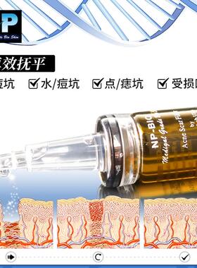 加拿大NPBIO痘坑修复剂精华质地直接涂抹去痘印痘疤抚平痘坑凹洞