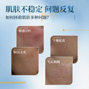 素秀臣氏壬二酸精华乳补水保湿滋润清爽不油腻改善暗沉提亮肤色