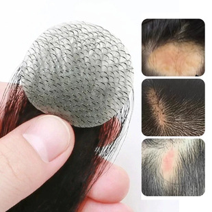 生物头皮疤痕贴刘海片鬓角补发男女全真人发m型前额发际线假发贴