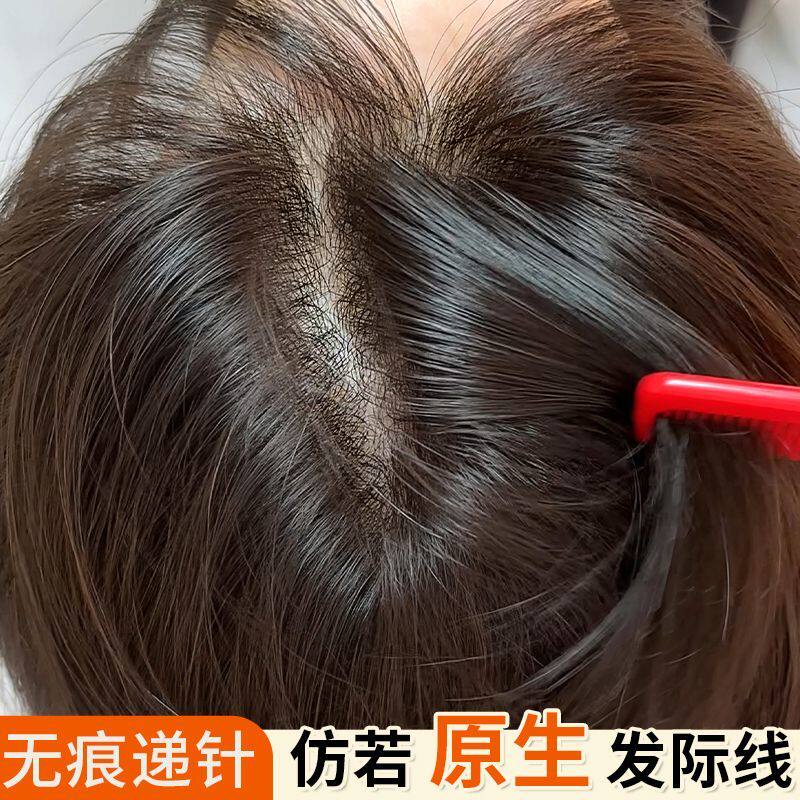 前额无痕高颅顶增发量刘海递针图片