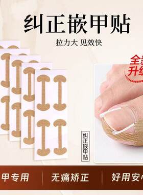 甲沟矫正器嵌甲垫片趾甲长肉里正甲贴正甲扣专用修脚刀工具炎指甲