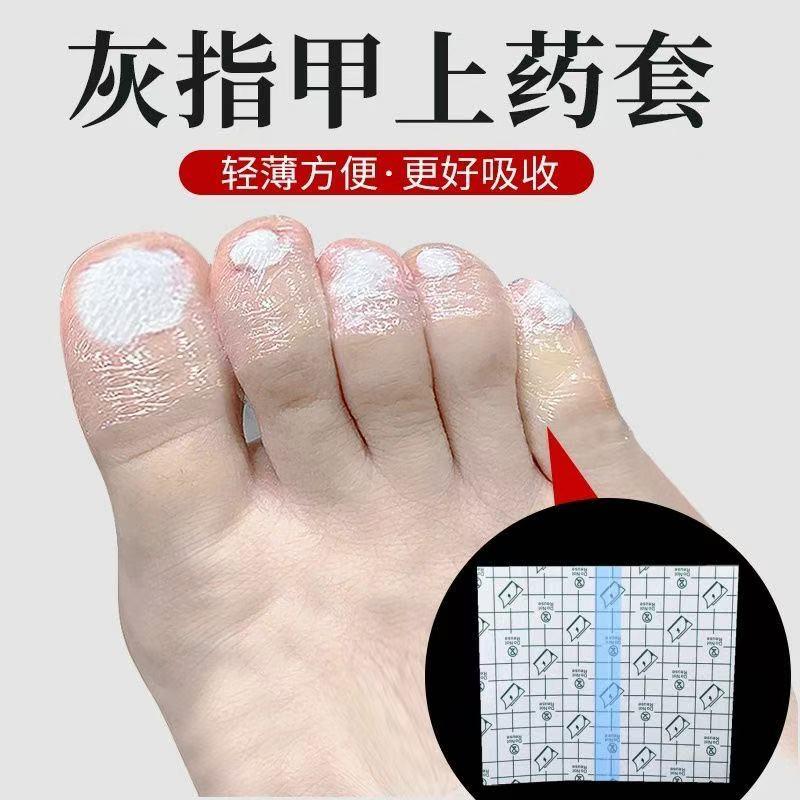 指甲上药套灰指甲脚趾手指保护套