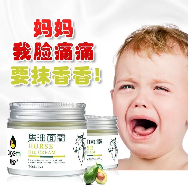 稚珍婴儿童马油面霜秋冬防皴冻皲裂宝宝擦脸防干红滋润补水保湿