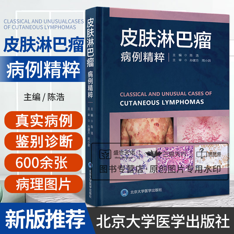 皮肤淋巴瘤病例精粹 陈浩 皮肤病学诊断病理皮肤科临床病理学血液学治疗临床实践真实病例检查鉴别诊断肿瘤学书籍