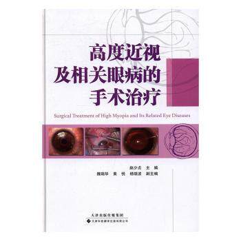 asy 高度近视及相关眼病的手术治疗 赵少贞　主编 9787543335219 天津科技翻译出版公司