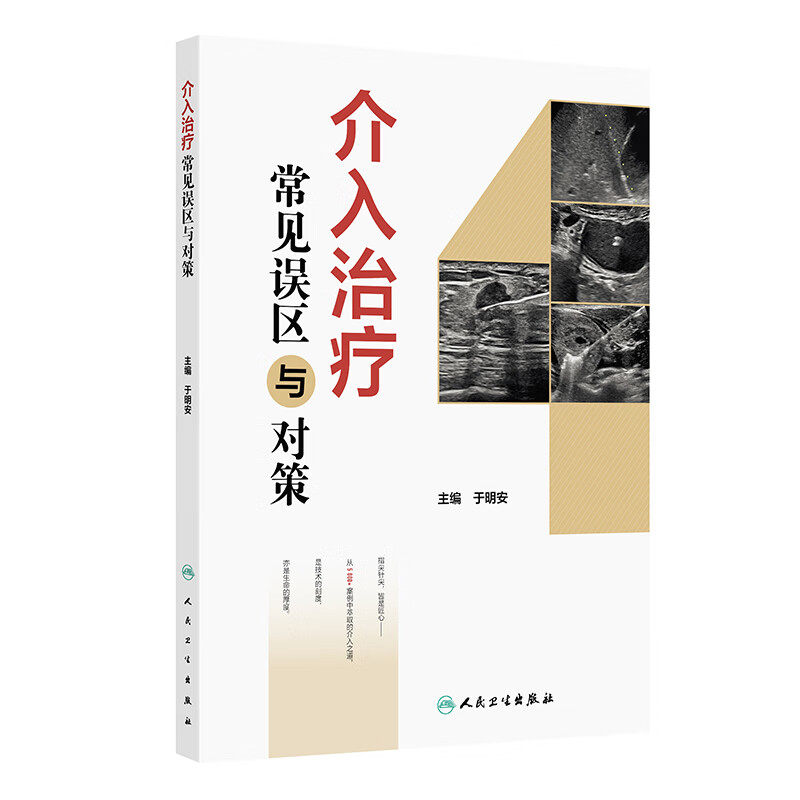 介入治疗常见误区与对策 于明安 详细分析整理病例中出现的常见误区 并给出相应对策 配有部分典型病例手术视频 人民卫生出版社