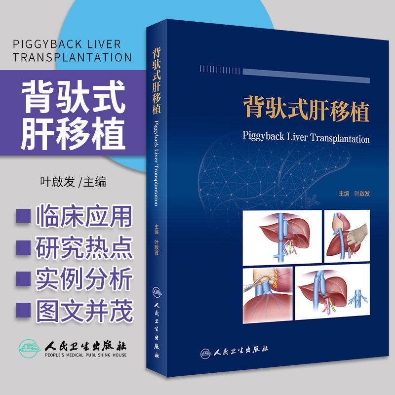 背驮式肝移植 叶啟发主编 背驮式肝移植基础研究临床应用 肝移植术前及术后管理 创新术式规范解读 人民卫生出版社9787117337618