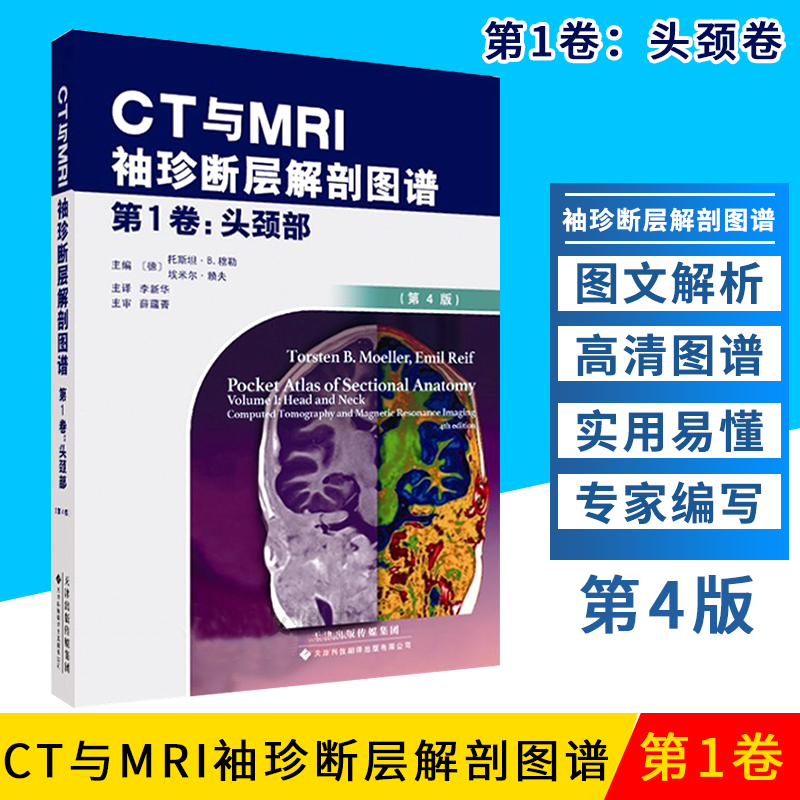 CT与MRI袖珍断层解剖图谱 头颈部 头颈部影像诊断学 头影测量 ct读片 医学影像 ct诊断与临床 天津科技翻译出版有限公司 书籍/杂志/报纸 影像医学 原图主图