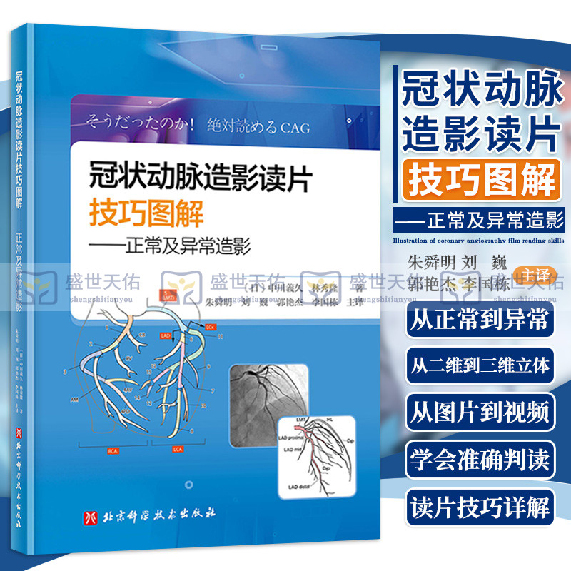 冠状动脉造影读片技巧图解正常