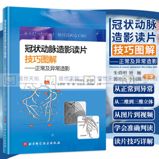 冠状动脉造影读片技巧图解正常及异常造影冠脉造影图片技巧图解冠状动脉造影读片图解快速进阶PCI达人冠脉结构中川义久林秀隆