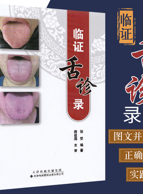 临证舌诊录 张坚编著 舌诊书图解舌诊精准辨证与开方入门图谱教程中医养生书籍舌像舌苔辨析临床病症望舌诊病舌诊入门与临证