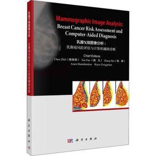assessment diagnosis 乳腺癌风险评估与计算机辅助诊断 aided computer and risk cancer breast 乳腺X线图像分析 asy