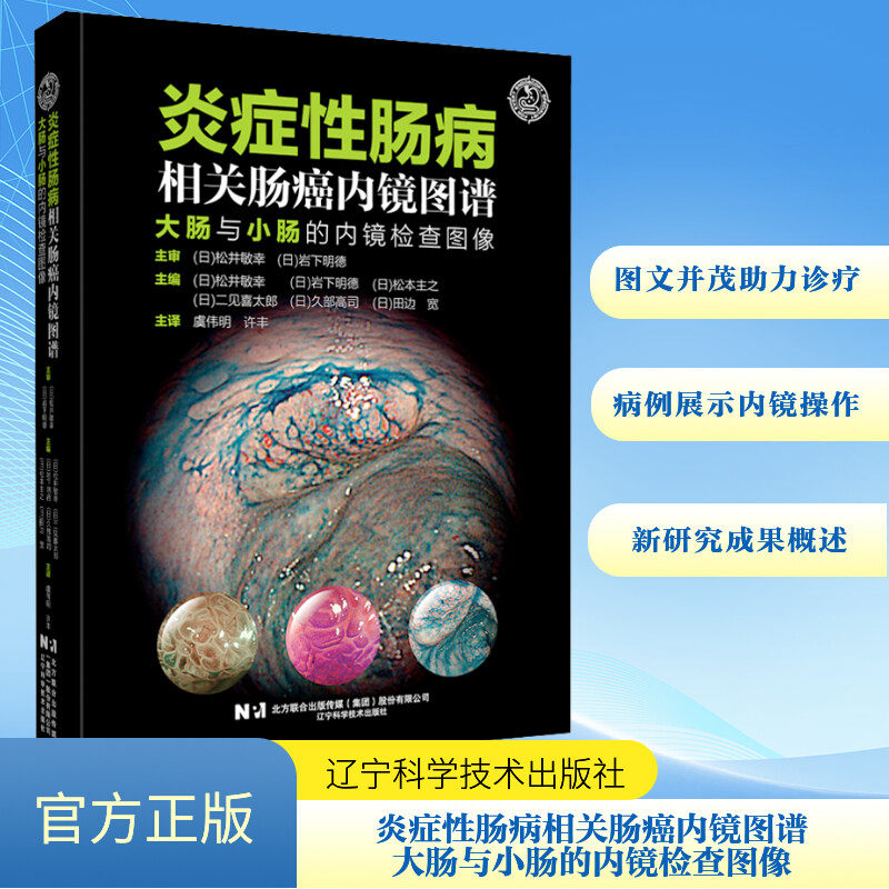 asywx 炎症性肠病相关肠癌内镜图谱 大肠与小肠的内镜检查图像 (日)松井敏幸 等 编 虞伟明,许丰 译 9787559134295