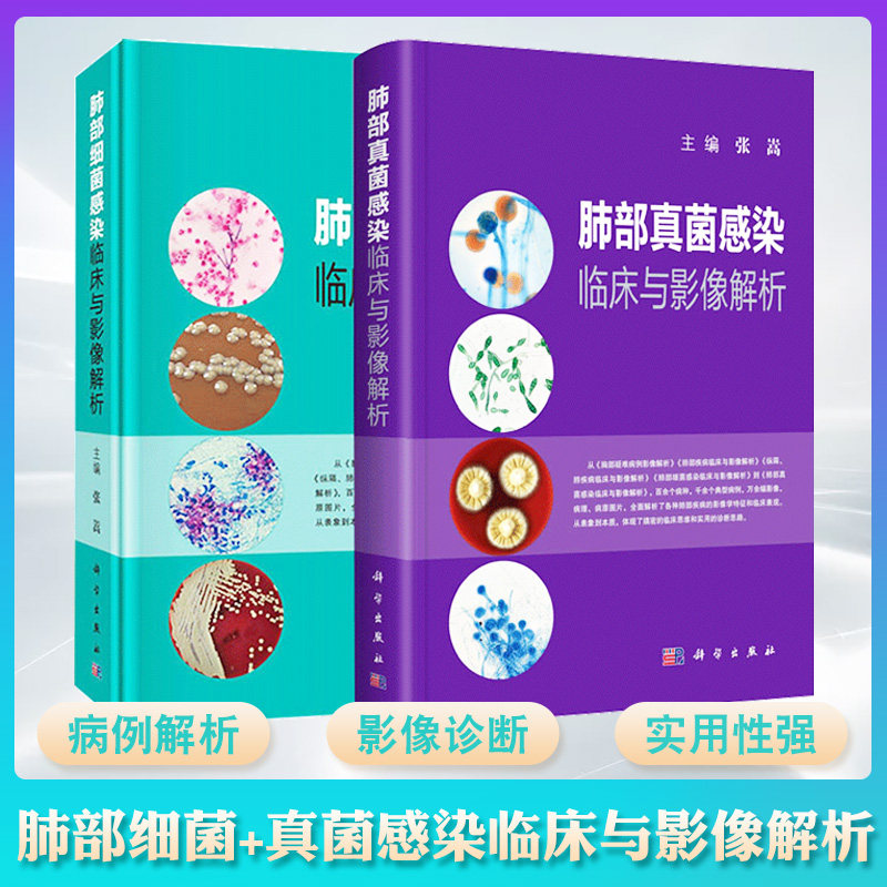 肺部细菌感染临床与影像解析+肺部真菌感染临床与影像解析 套装两本 张嵩主编 科学出版社 影像医学参考书 肺部影像诊断和鉴别诊断