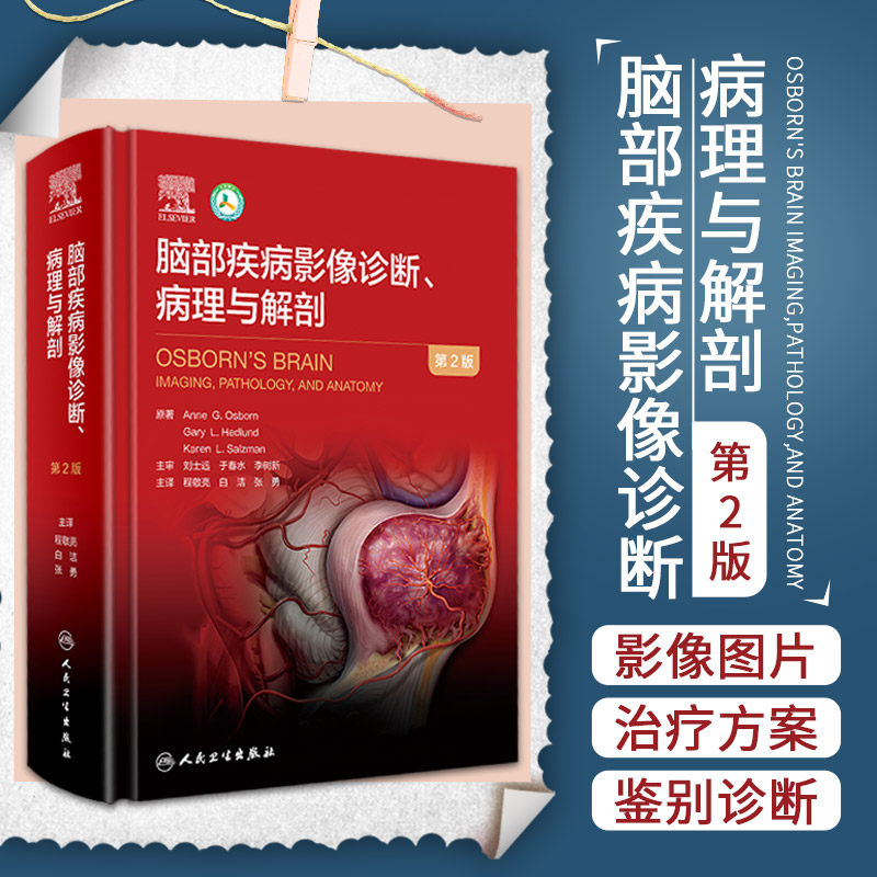 脑部疾病影像诊断 病理与解剖 影像医学 放射医学 别从流行病学 病因学临床表现等的论述 程敬亮 白洁 张勇 主译 人民卫生出版社