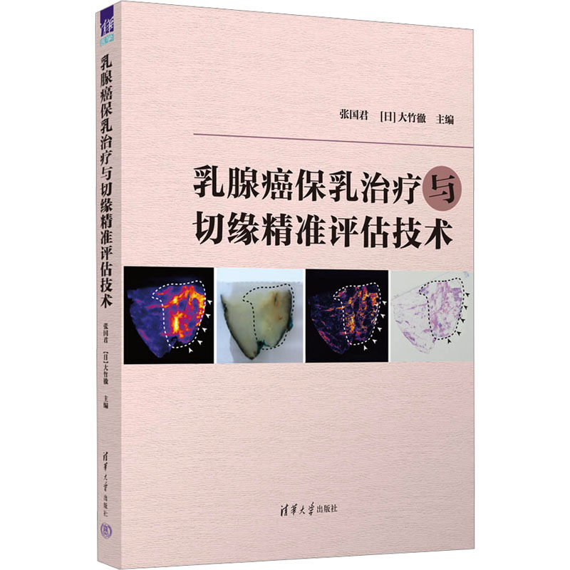 asy 乳腺癌保乳治疗与切缘精准评估技术 张国君，[日]大竹徹 9787302644217 清华大学出版社