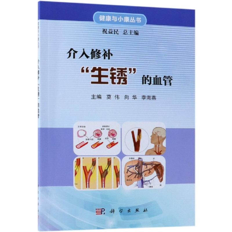 asy 介入修补"生锈"的血管 莫伟,向华,李海燕 著 9787030591920 科学出版社