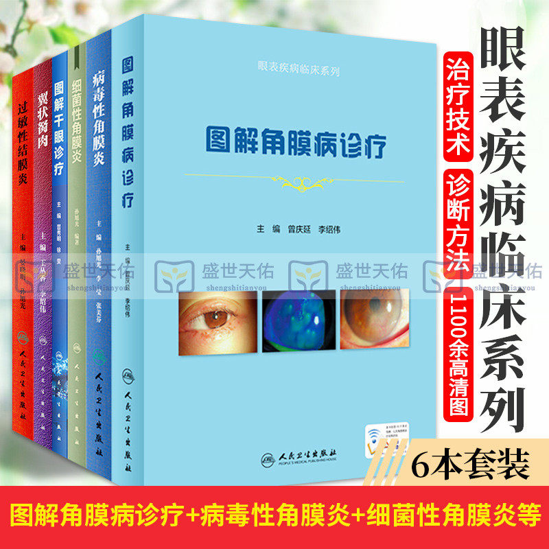 眼表疾病临床系列 图解角膜病诊疗+病毒性角膜炎+细菌性角膜炎+图解干眼诊疗+翼状胬肉+过敏性结膜炎 套装6本 人民卫生出版社