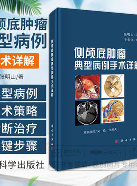 侧颅底肿瘤典型病例手术详解