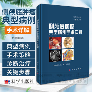 侧颅底肿瘤典型病例手术详解 听神经瘤 2型神经纤维瘤病的手术治疗 乙状窦后入路切除侵犯乙状窦的肿瘤 张明山 科学出版社