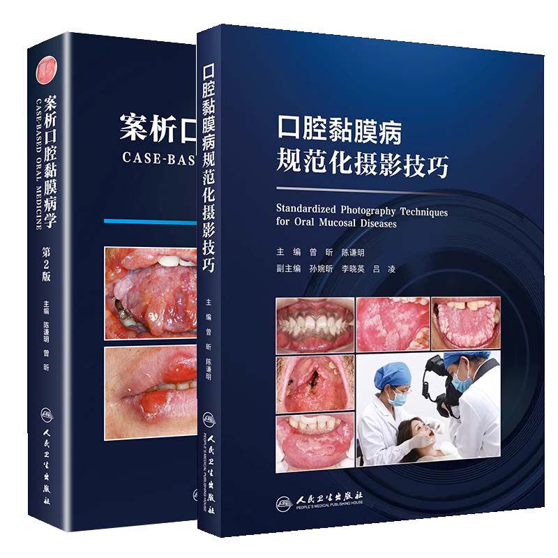 【全2册】口腔黏膜病规范化摄影技巧+案析口腔黏膜病学第2版 口腔黏膜临床摄影的基本知识 牙周纤维化膜龈美学 人民卫生出版社