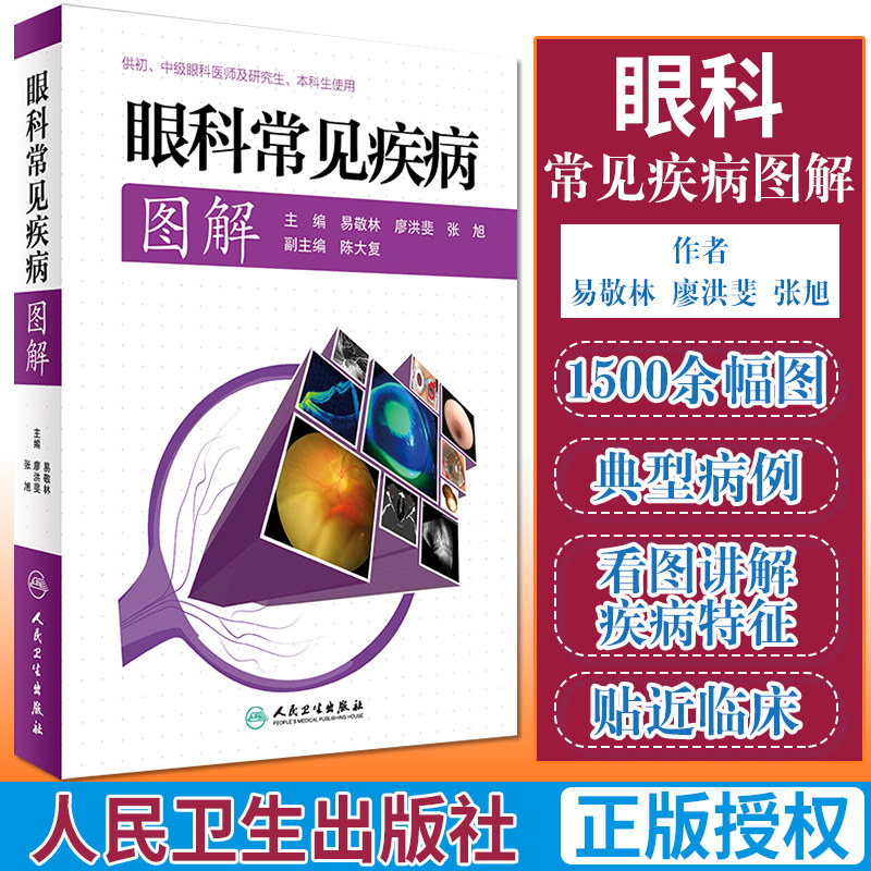 正版 眼科常见疾病图解 易敬林 廖洪斐 张旭 主编 9787117229142 眼科学参考书书籍 人民卫生出版社