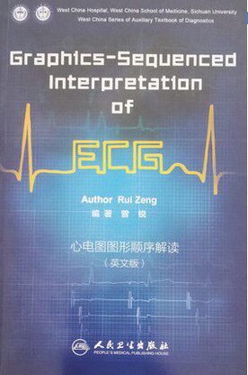 包邮正版 graphics-sequenced interpretation of ecg 心电图图形顺序