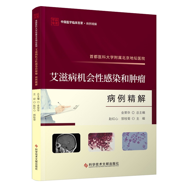 都医科大学附属北京地坛医院艾滋病机会性感染和肿瘤病例精解 赵红心 郜桂菊 主编 科学技术文献出版社 卡波西肉瘤 淋巴瘤