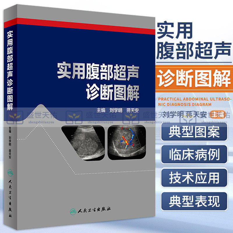 正版 实用腹部超声诊断图解 刘学明 蒋天安 主编 影像医学 临床腹部超声诊断治疗学书籍入门检查指南 精细讲解 人民卫生出版社