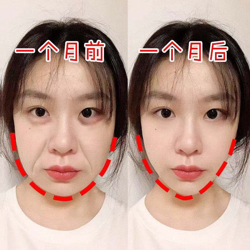 【小红书推荐 挑战30天淡化法令纹 】法令纹精华帖跟法令纹说拜拜