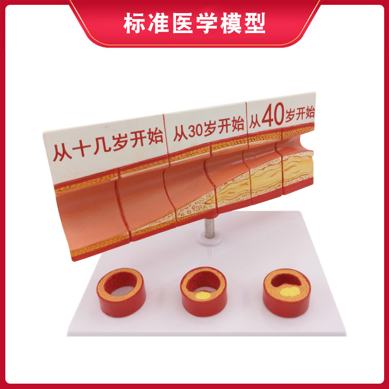 인간 혈관 모델 동맥 혈관 방해 변경 데모 교육 모델 장기 해부학 구조 계층 모델