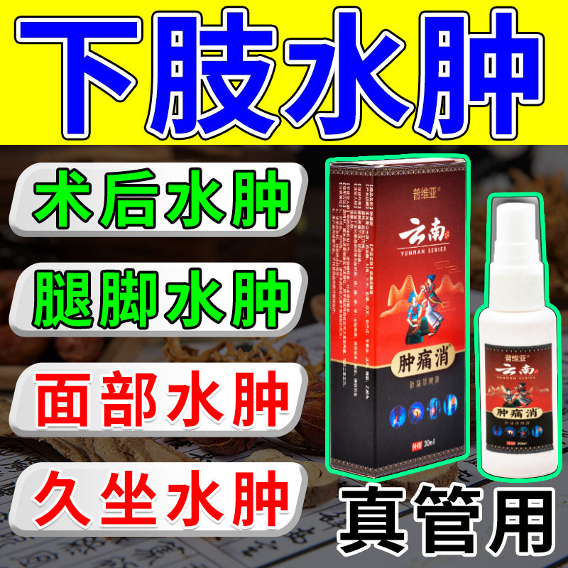 消脚肿水肿神器老人利尿排水肿消脸部小腿部下肢浮肿专用喷剂