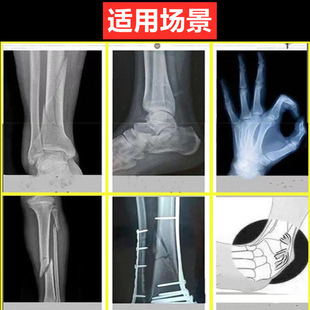 骨裂跌打扭伤闪腰崴脚接骨老黑膏续筋膏黑玉断续膏崴伤韧带软组织