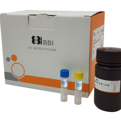 上海生工生物促销，定量试剂盒