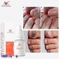 美颜琼 薰衣草 LAVENDER NAIL ESSENTIAL OIL指甲精油 MYQ013