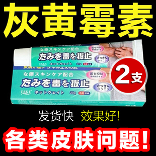 【2支】灰黄霉素软膏辉煌霉素真菌甲头人用外用乳膏涂抹正膏