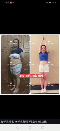 中医穴位经络蛋白开穴减肥埋线减肥针灸拔罐减肥也是正规培训机构