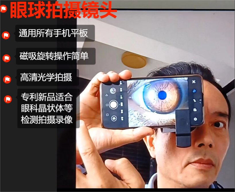 手机外置高清镜头眼睛眼球晶状体医疗检测拍摄录像微距放大摄像头